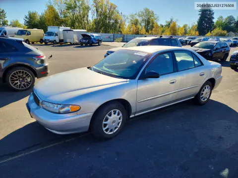 2G4WS52J531276508 — 2003 Buick Century, Мелкие вмятины и царапины, фото до ремонта
