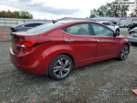 2014 Hyundai Elantra Limited VIN 5NPDH4AE2EH470598 фото 3