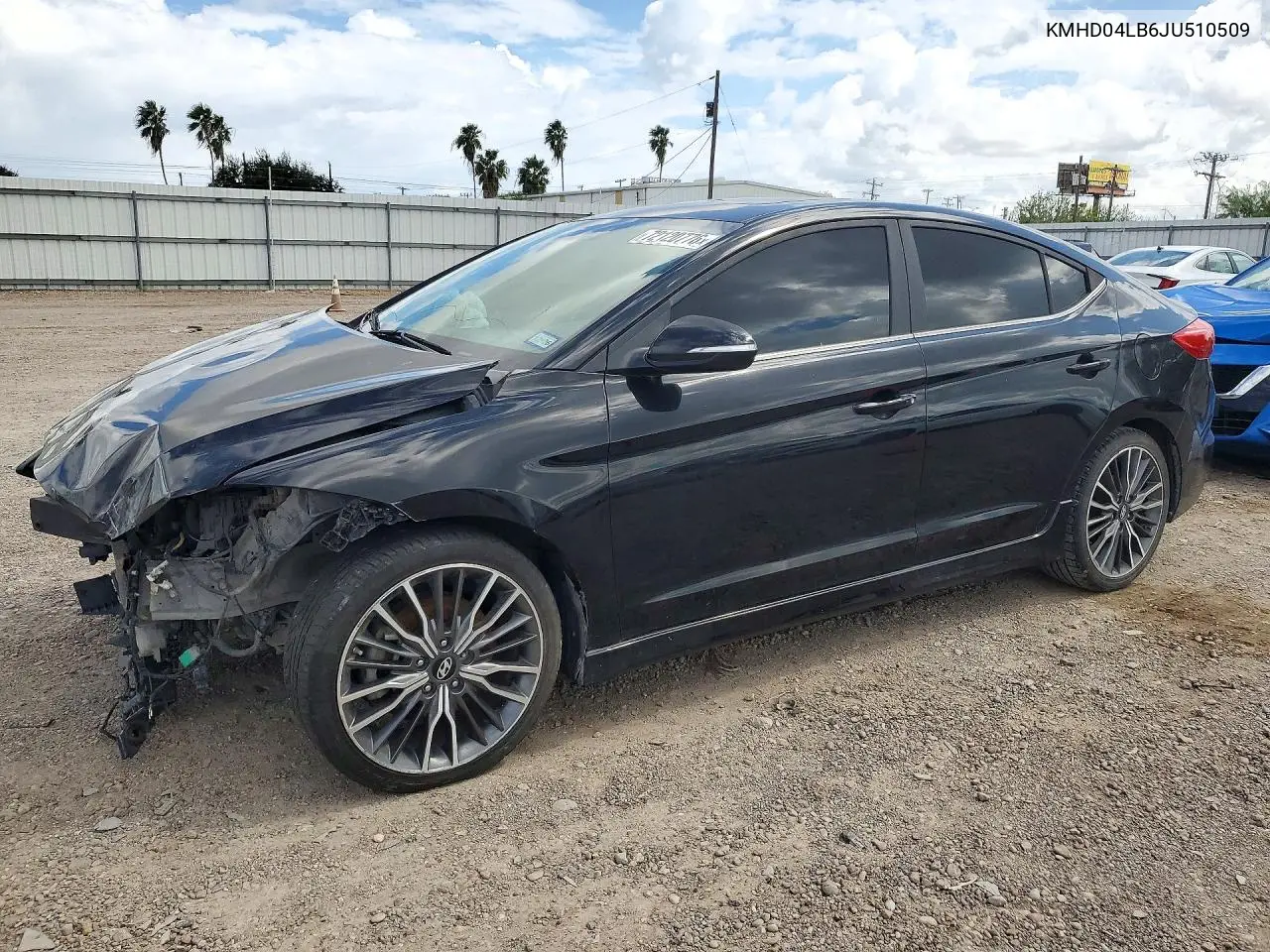 KMHD04LB6JU510509 Hyundai Elantra 2018 — повреждение Передняя часть, фото до ремонта