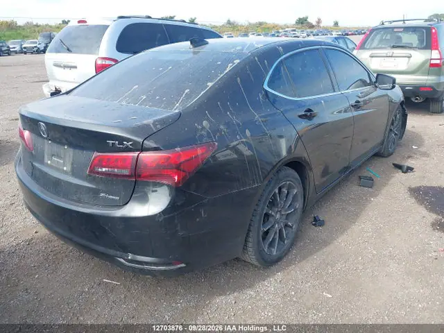 19UUB3F50FA801127 — 2015 Acura TLX TECH, фото 4 с аукциона IAAI 14.10.2026, Передняя часть