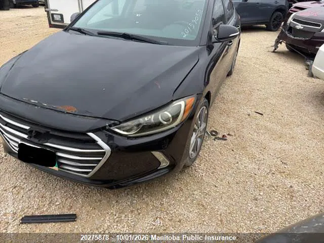2017 Hyundai Elantra Limited VIN KMHD84LF8HU157289 фото 1