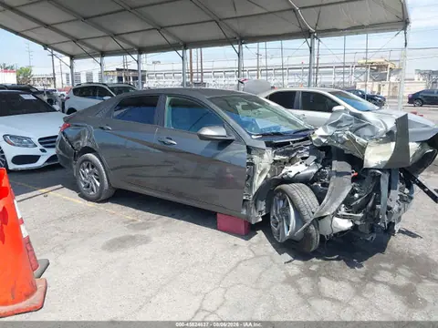 KMHLM4DG5RU731945 — 2024 Hyundai Elantra SEL, Передняя часть (Front End), фото до ремонта