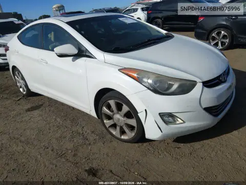 5NPDH4AE6BH075996 — 2011 Hyundai Elantra, Естественный износ, фото до ремонта
