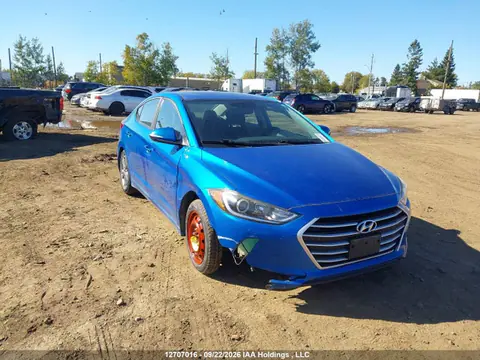 KMHD84LF9JU497962 — 2018 Hyundai Elantra, Передняя часть (Front), фото до ремонта