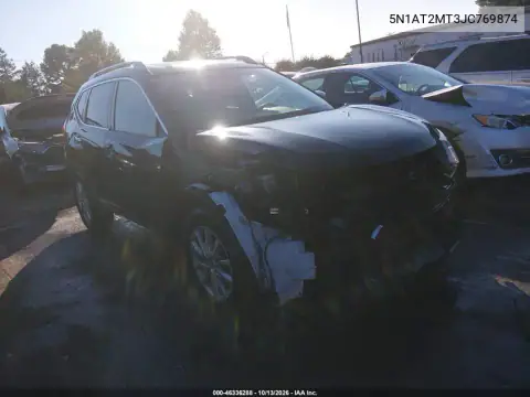 5N1AT2MT3JC769874 — 2018 Nissan Rogue, Передняя часть, фото до ремонта